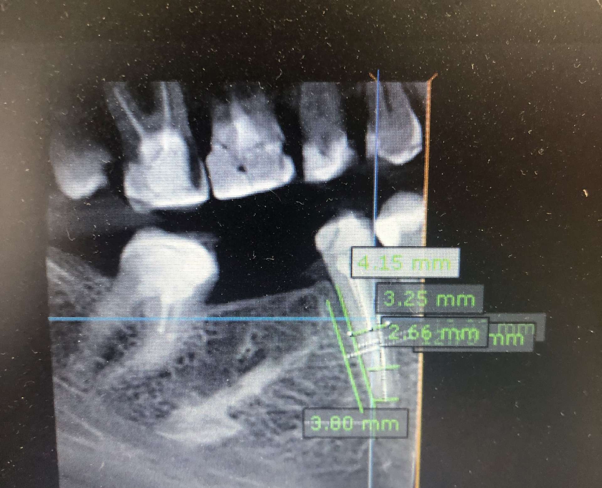 Oralna kirurgija s implantologijom - 